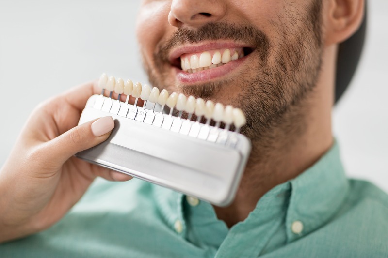 The Dental Boutique Venice | Veneers