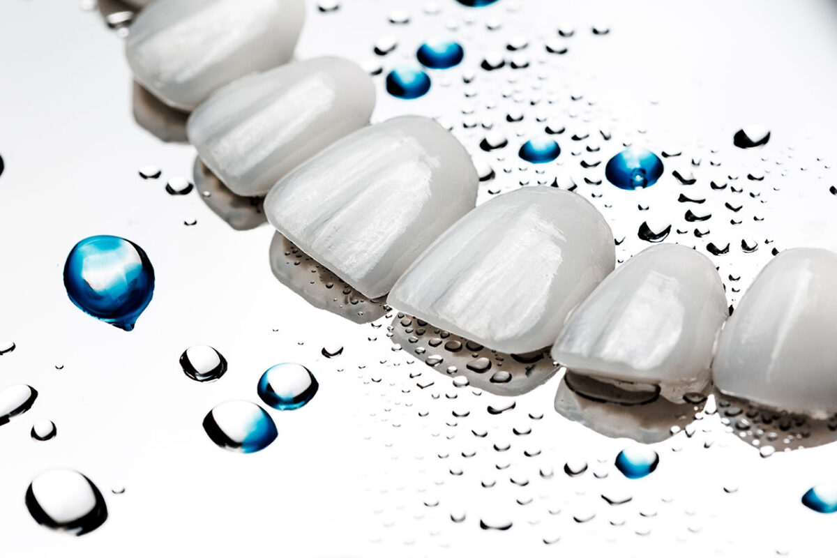 The Dental Boutique Venice | Porcelain Veneers in Venice, FL: How to Plan a Natural-Looking Smile Refresh